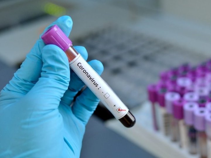 LA PARA: CONFIRMARON UN CASO DE CORONAVIRUS LA PARA: CONFIRMARON UN CASO DE CORONAVIRUS