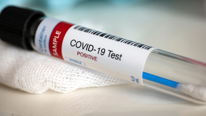 CORONAVIRUS: SANTA FE MARCÓ OTRO RECORD DE CASOS ESTE MARTES
