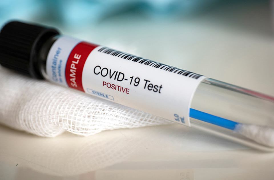 VILLA SANTA ROSA: CONFIRMAN DOS CASOS DE CORONAVIRUS VILLA SANTA ROSA: CONFIRMAN DOS CASOS DE CORONAVIRUS