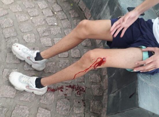 Morteros: en una pelea seis menores le dieron dos puñaladas a un chico