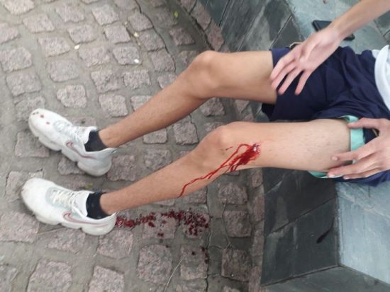 Morteros: en una pelea seis menores le dieron dos puñaladas a un chico