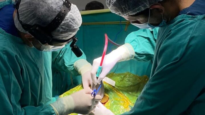 San Francisco: el Hospital Iturraspe realizó por primera vez una neurocirugía de alta complejidad