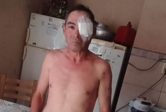 Morteros: pierde un ojo por una bala de goma y denuncia a la policía Morteros: pierde un ojo por una bala de goma y denuncia a la policía