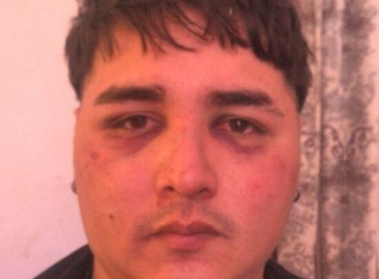 Morteros: golpearon a un joven con discapacidad a la salida de un bolinche