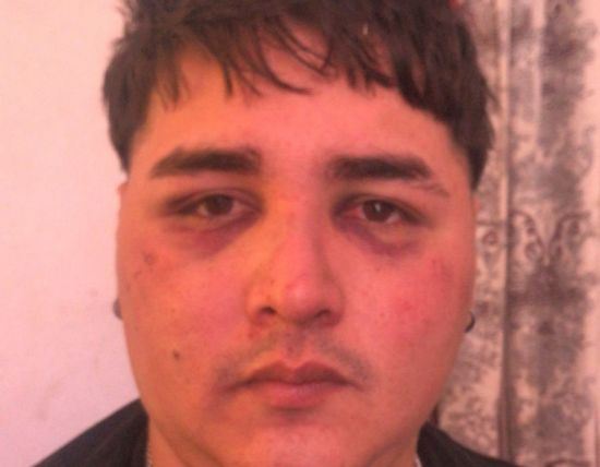 Morteros: golpearon a un joven con discapacidad a la salida de un bolinche